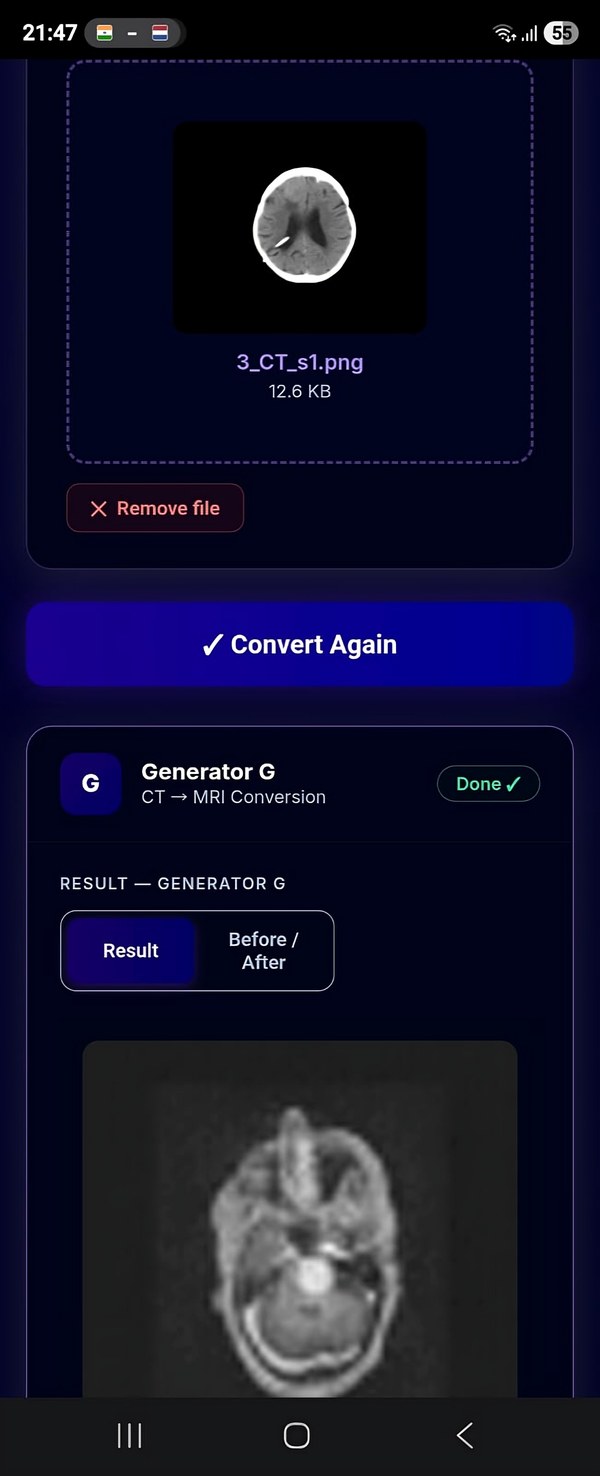 App demo: CT to MRI brain image conversion using Generator G — demonstration of real-time conversion outcome